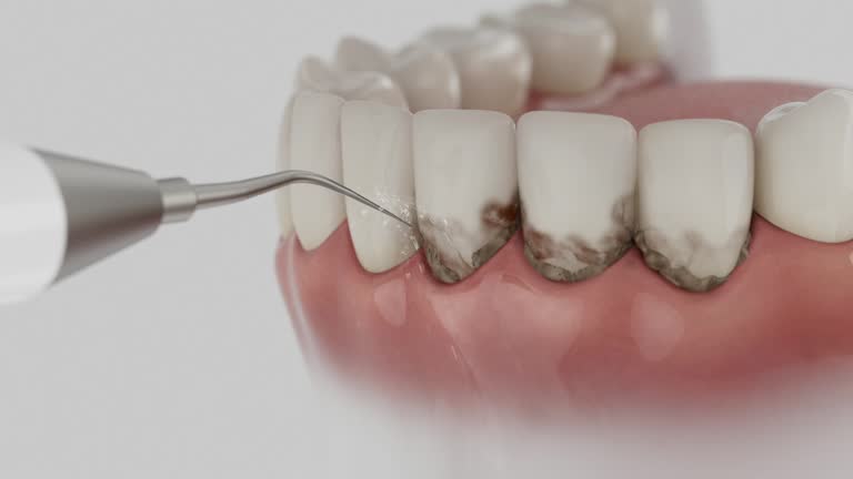 Reliable Dental contractor in Bound Brook, NJ by Dentist Open Now